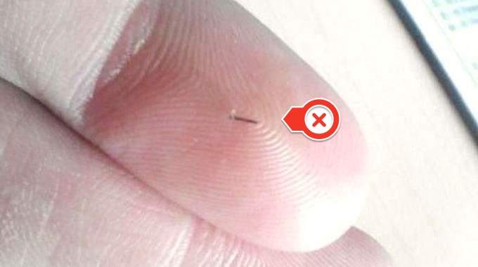 How to Remove a Embedded Thorn in Your Finger Easily.
