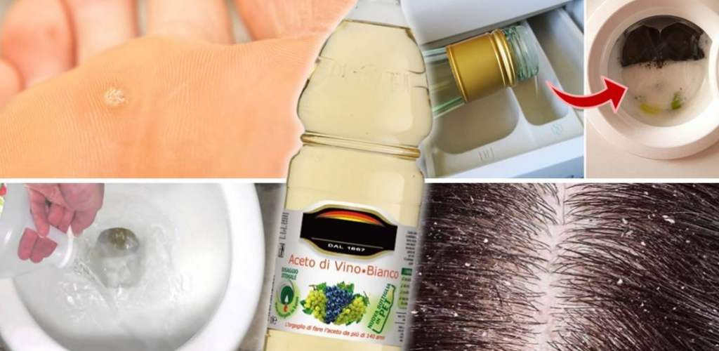 11 Strange But Very Useful Uses Of Vinegar You Didn’t Know About