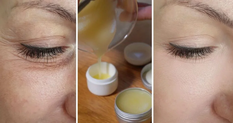 DIY cream with 3 ingredients to rejuvenate the eye area